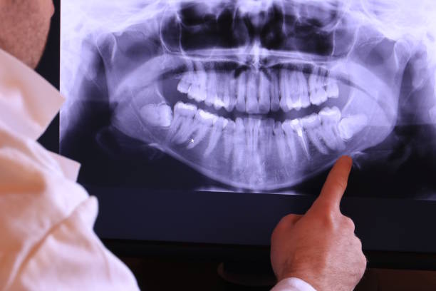 Best Orthodontic Emergency Dentist in Mountain View, CA