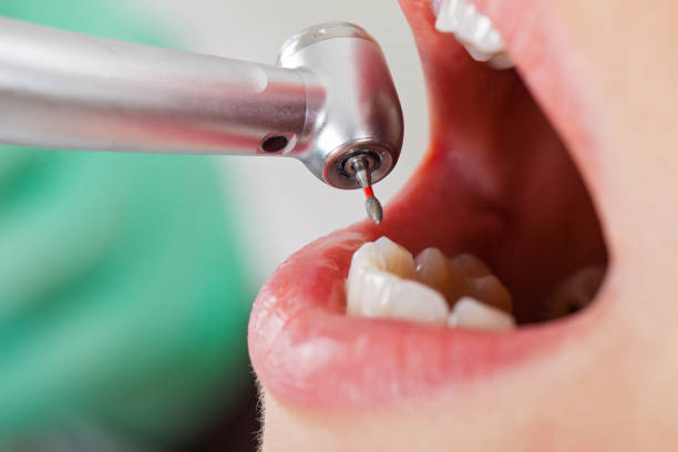 Best Mobile Emergency Dentist in Mountain View, CA
